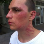 Când polițiștii te conduc la secție și-ți spun că ai căzut pe scări florin micu